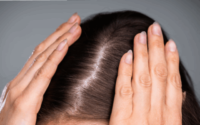 Why Is My Hair Thinning As I Get Older