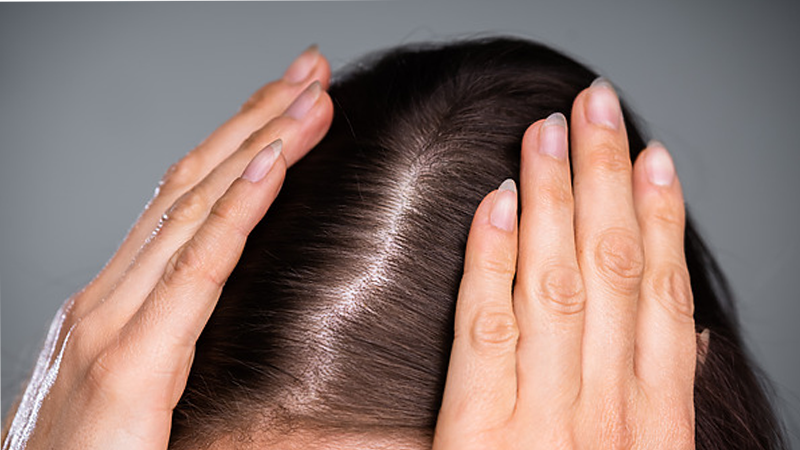 Why Is My Hair Thinning As I Get Older